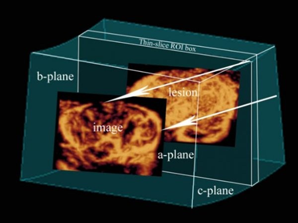 ecografia ad alta risoluzione con sonda lineare 10–15 MHz